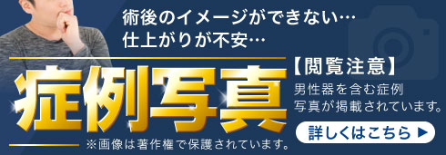 症例写真