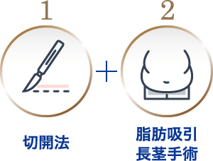 切開法 + 脂肪吸引長茎手術
