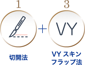切開法 + VYスキンフラップ法