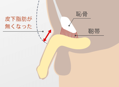 施術後