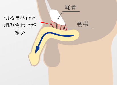 施術前