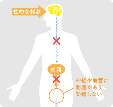 神経や血管に問題があり勃起しない