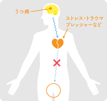 うつ病・ストレス・トラウマプレッシャーなど
