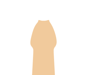 真性包茎